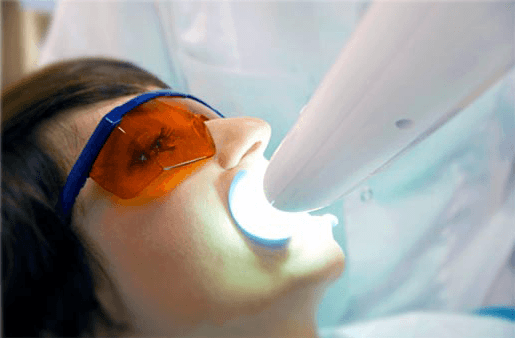 Understanding the Causes of Teeth Sensitivity Harrogate