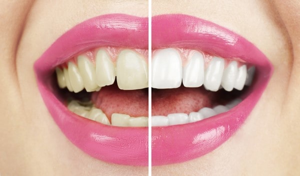 What Early Signs of Oral Cancer Should You Never Ignore Harrogate?