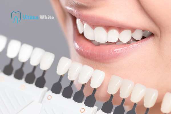 How to Maximise the Results of Your Laser Teeth Whitening Treatment Harrogate