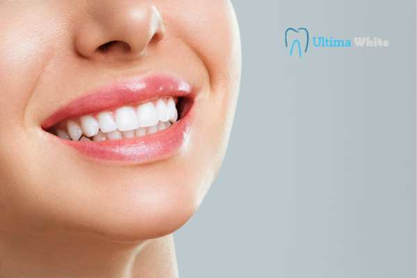 Common Mistakes That Can Ruin Your Whitening Results Harrogate