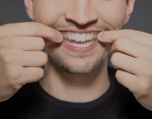 Overview of Home Teeth Whitening Kits Harrogate