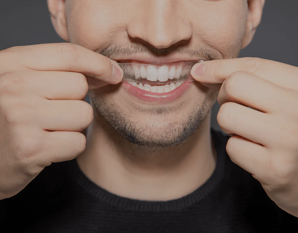 Can You Whiten Natural Teeth Without Harsh Chemicals Harrogate?