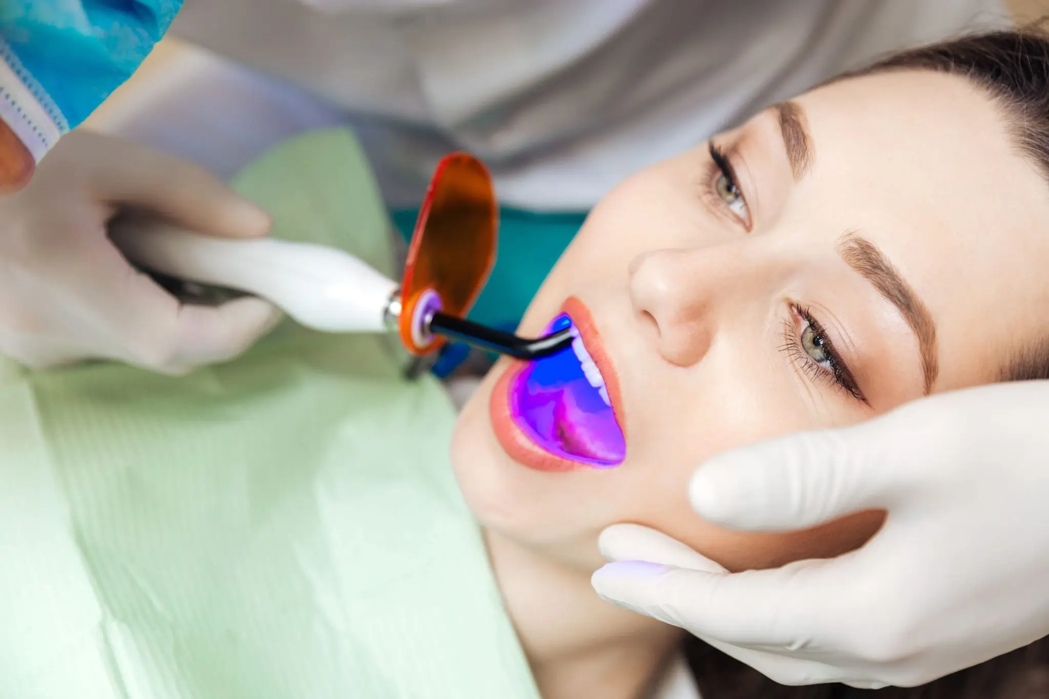 What Exactly Is Laser Teeth Whitening and How Does It Work Harrogate?