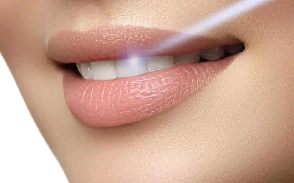 Is Laser Teeth Whitening Safe for Your Teeth and Gums Harrogate?