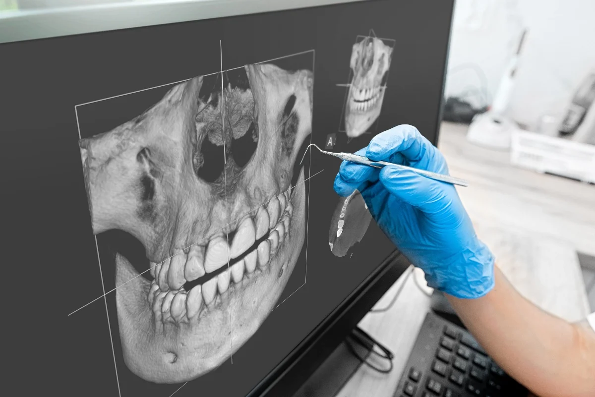 How Is AI Transforming Dental Treatment Planning Harrogate?