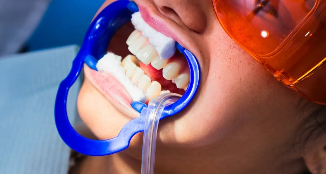 What Can You Do Before Treatment to Reduce Pain Harrogate?