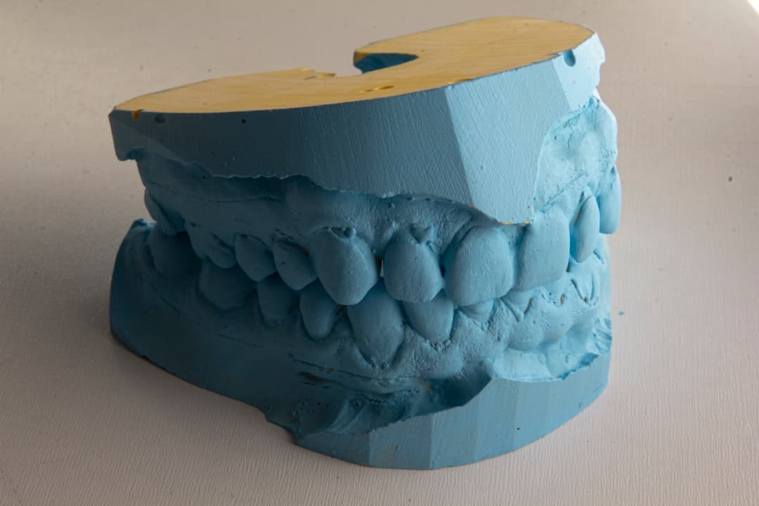 How Do Dental Implants Improve Jawbone Health and Oral Function Harrogate?