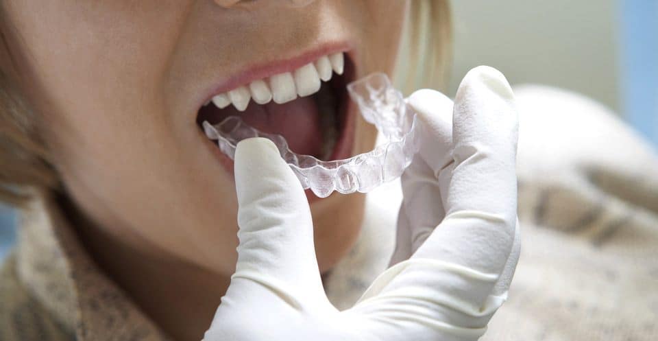 Can Bruxism Affect Your Sleep Quality Harrogate