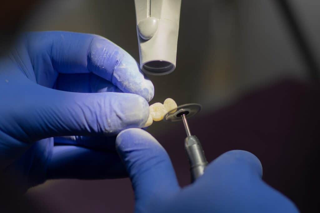 Customised Dental Solutions: Crowns, Aligners, and Implants Harrogate