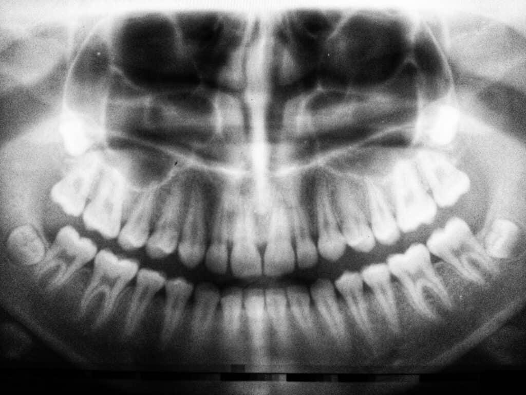 The Future of 3D Printing in Oral Healthcare Harrogate